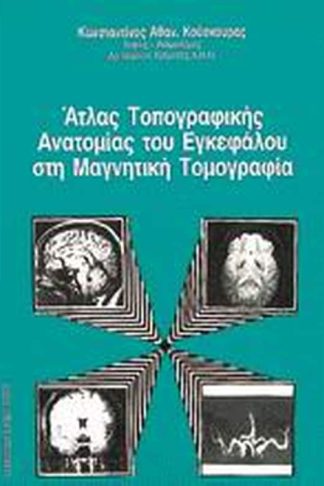 Άτλας τοπογραφικής ανατομίας του εγκεφάλου στη μαγνητική τομογραφία